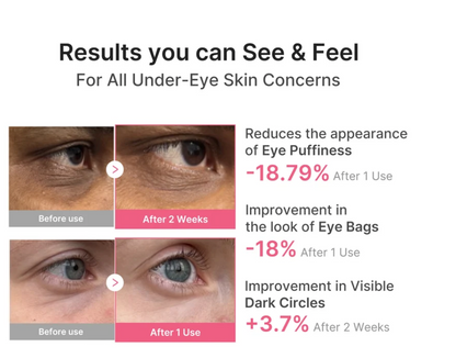 Medifube Korean PDRN Collagen Under Eye Patches